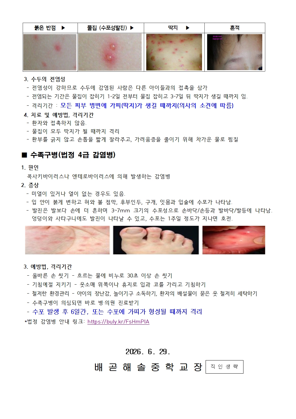 유행성 이하선염 수두,수족구 예방 재안내002